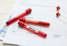 Brasil está entre países com aumento de novos casos de HIV, aponta relatório do Unaids